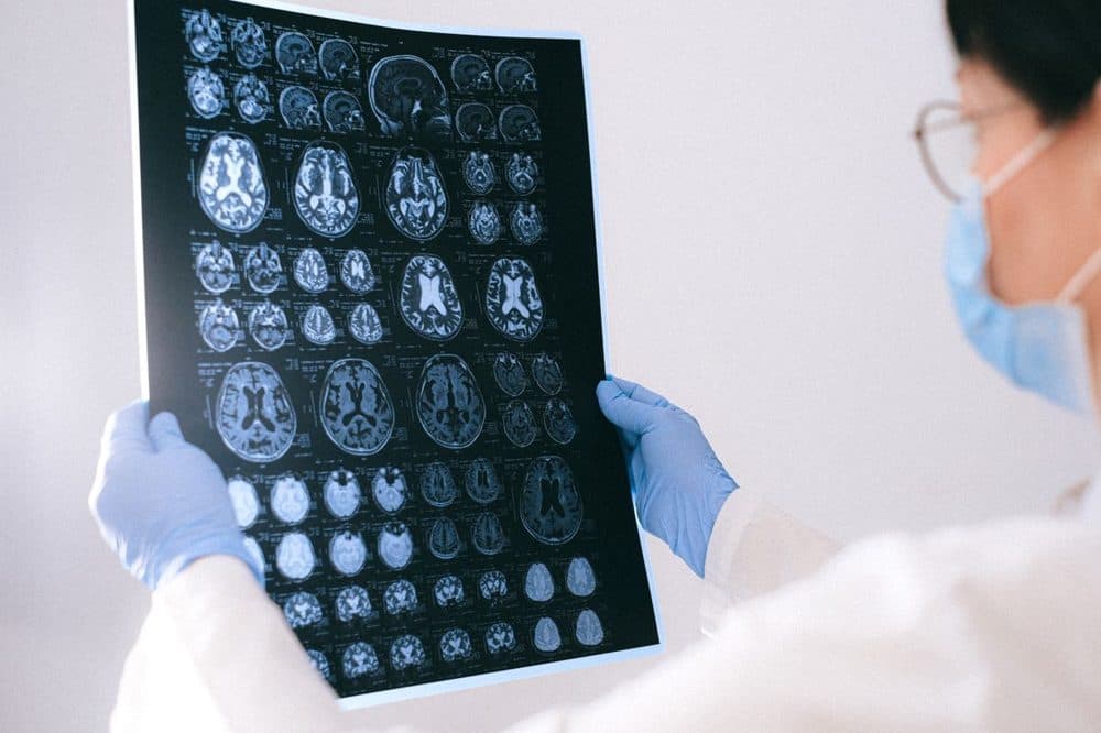 Evaluación neurológica en Alta Salud